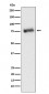 Anti-GRK3 Monoclonal Antibody